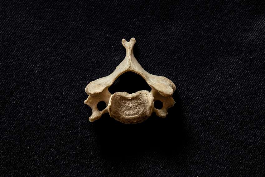 The Invisible Made Standard: How Surgeons Built a Universal Map of the Spine